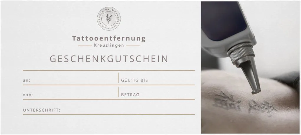 Vorderseite vom Gutschein für eine Tattooentfernung